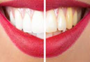 पीले दांतों की समस्या को दूर करने के लिए इन आसान उपायों का करें इस्तेमाल